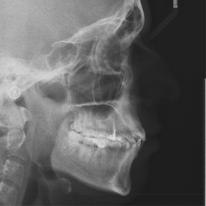 Костная хирургия