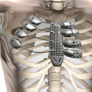 Инструменты  для торакальной хирургии
